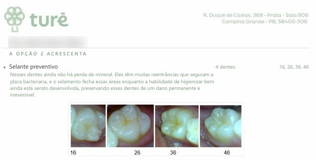 Trecho do orçamento com o selante preventivo explicado e as fotos dos quatro dentes