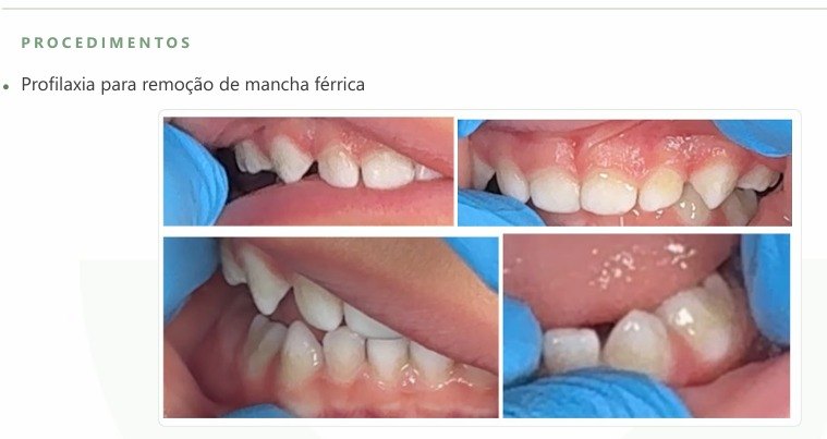 Trecho do orçamento com as fotos da mancha nos dentes
