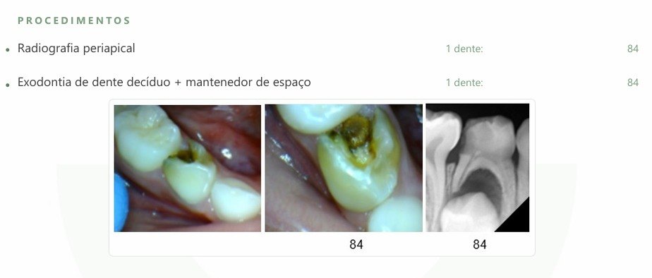 Trecho do orçamento com as fotos e a radiografia do dente