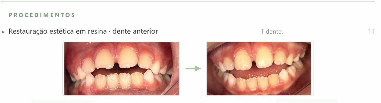 Trecho do orçamento mostrando o antes e o depois da restauração